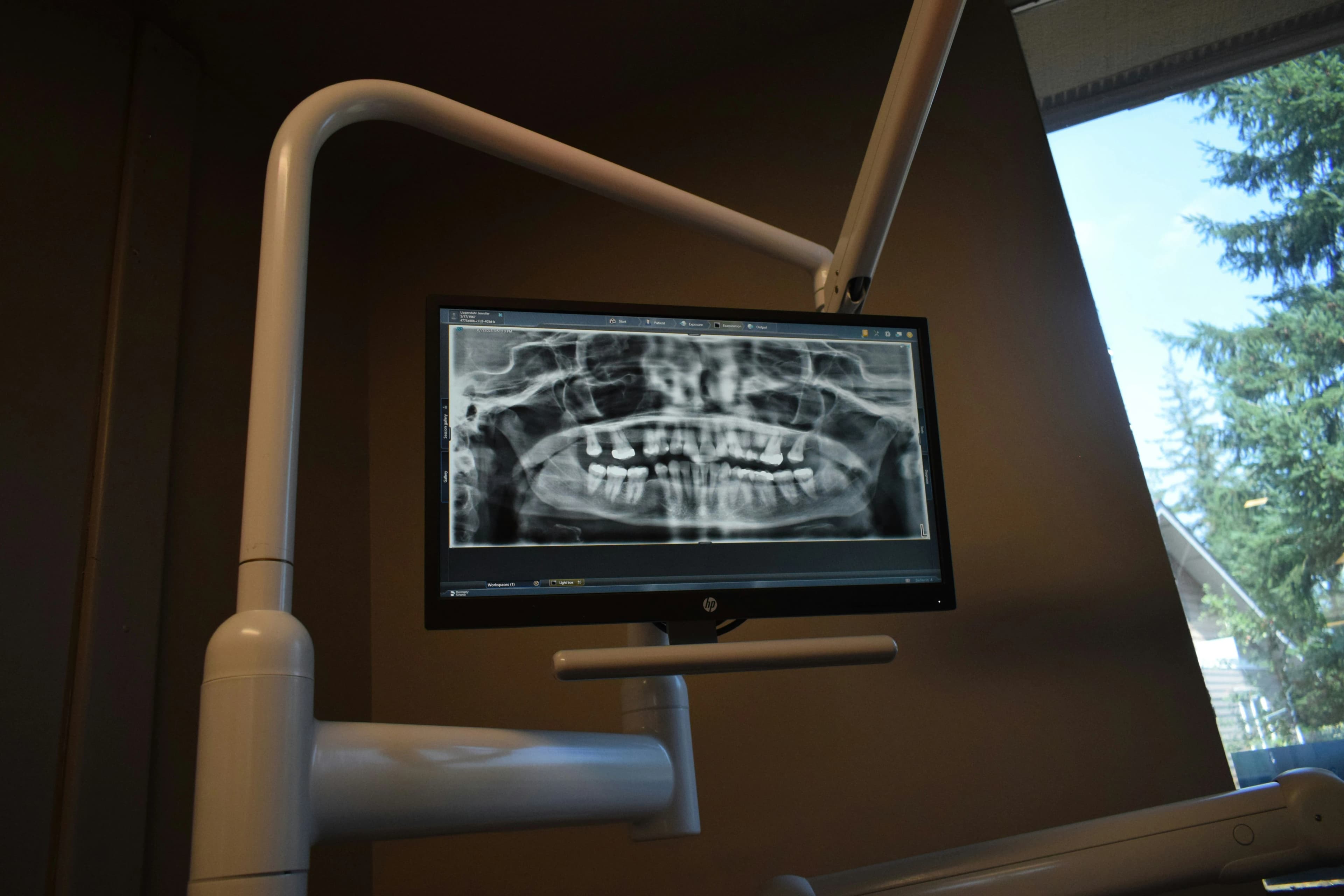 A full panoramic dental x-ray on a chairside monitor